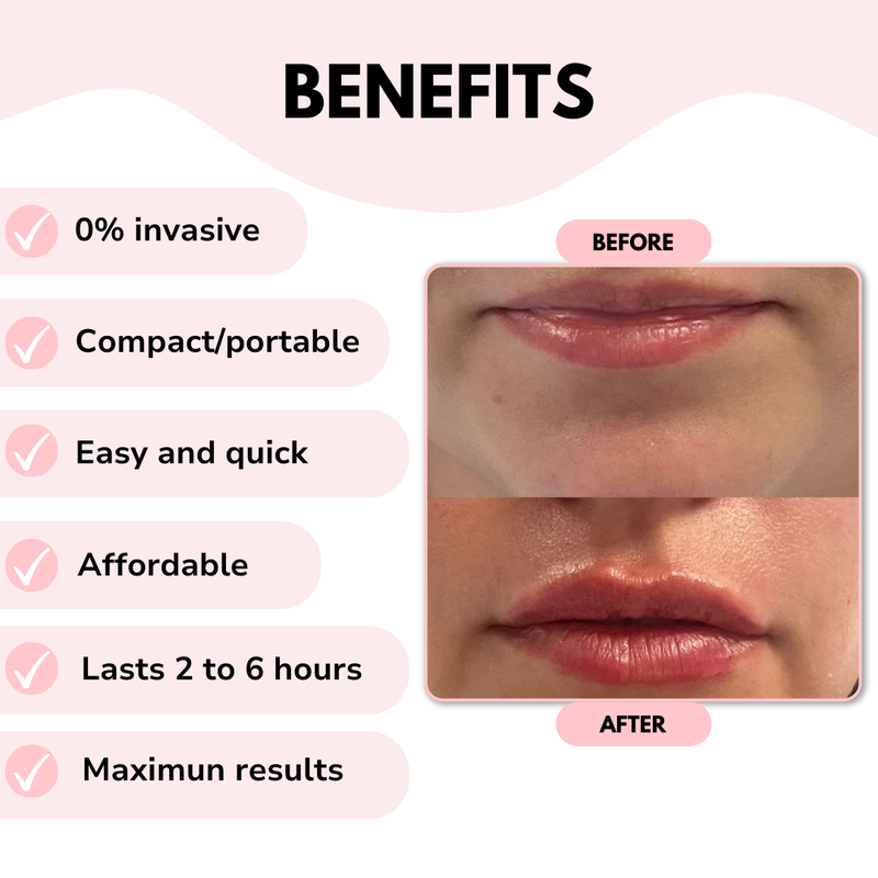 Lip Gizmo by Oveon - Immediate and Natural Lip Enhancement