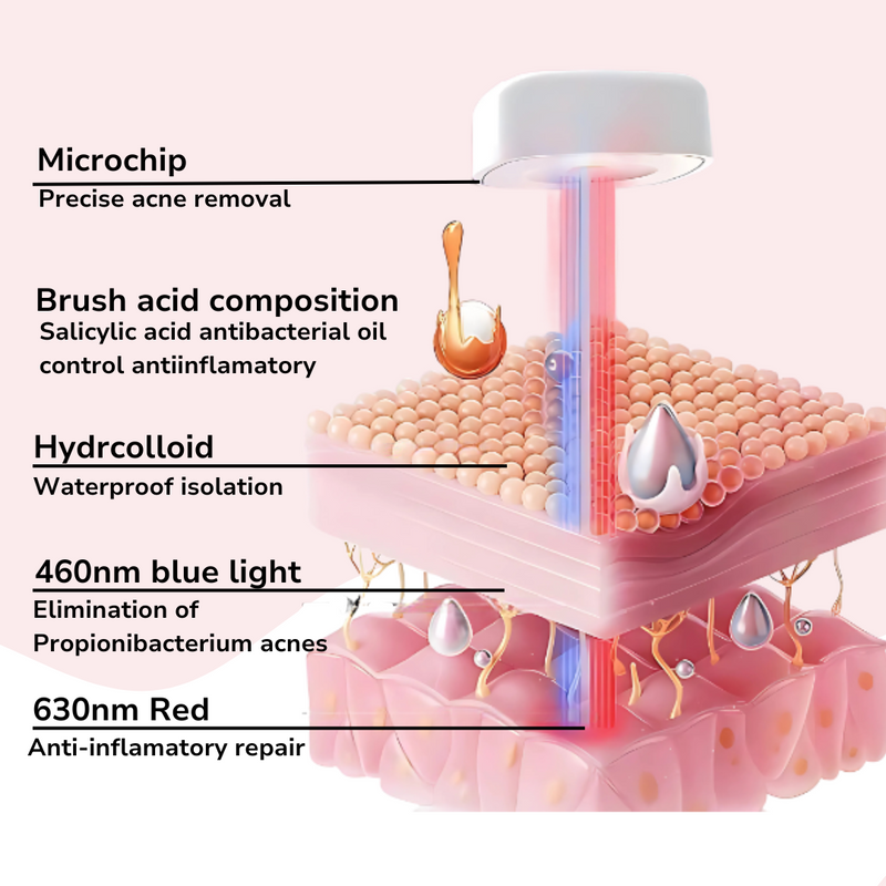 OVEON BYE ACNE PRO KIT